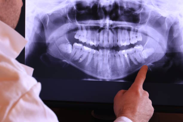 Best Urgent Tooth Repair  in Reidsville, NC